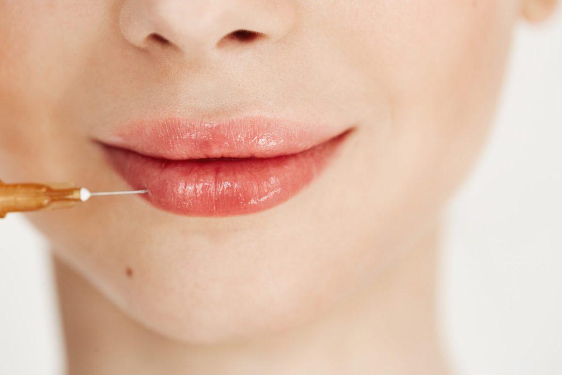 Ce trebuie să faci înainte de operația de mărire a buzelor: Sfaturi și sugestii importante
