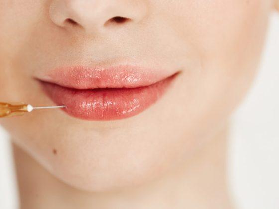 Ce trebuie să faci înainte de operația de mărire a buzelor: Sfaturi și sugestii importante